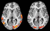 fMRI Brains