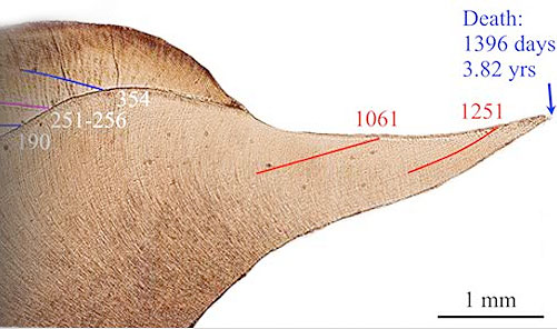 microscope slide of tooth