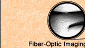 Fiber-Optic Imaging