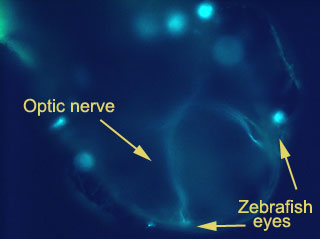 Fish embryo brain showing optic nerve development