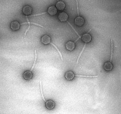 micrograph of bacteriophages